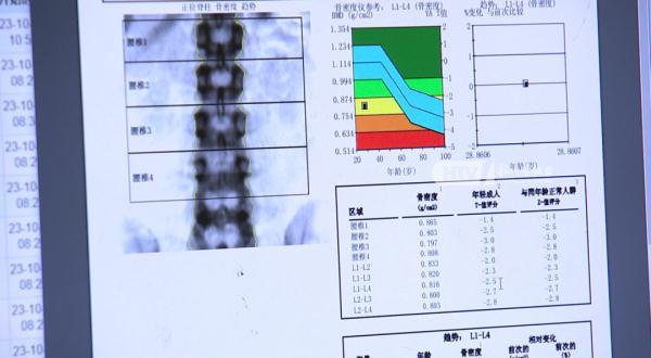 完美体育女子每天3杯咖啡被确诊骨质疏松 咖啡喝多了会有什么影响？(图1)